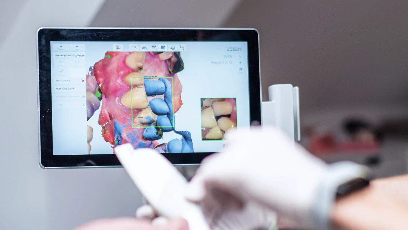 Empreinte optique numérique au cabinet dentaire du Docteur Elodie Bocquet à Douai